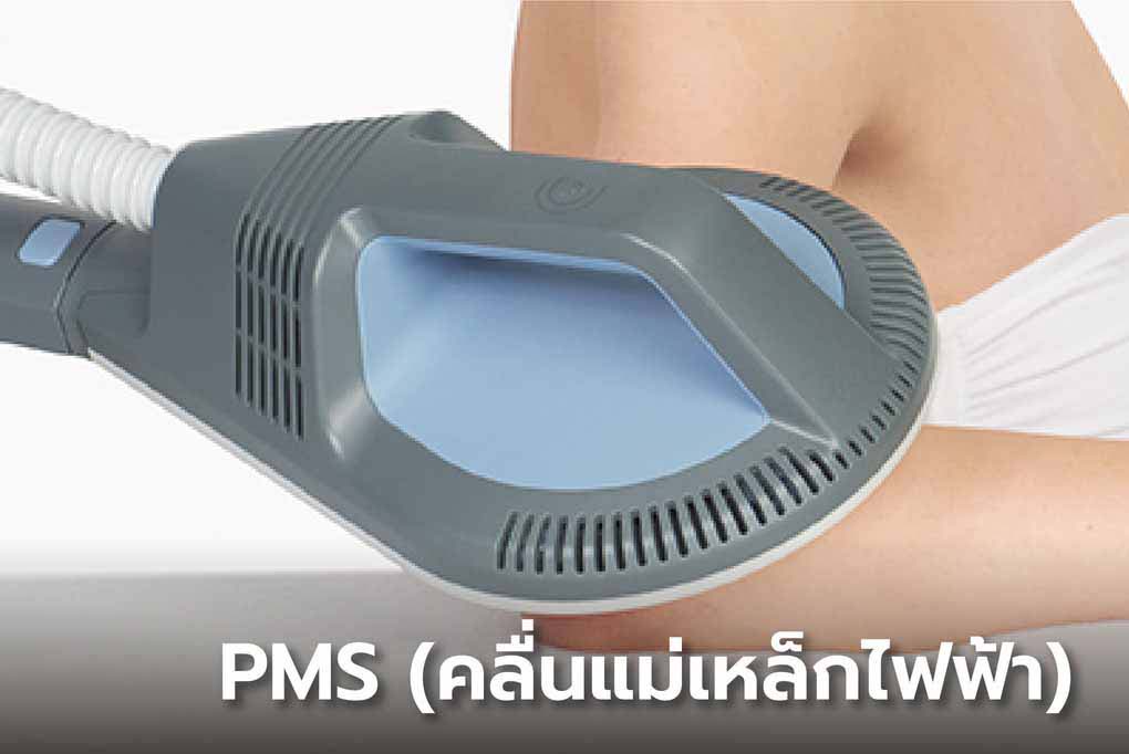 PMS (คลื่นแม่เหล็กไฟฟ้า)